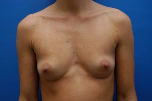 Simply Breasts